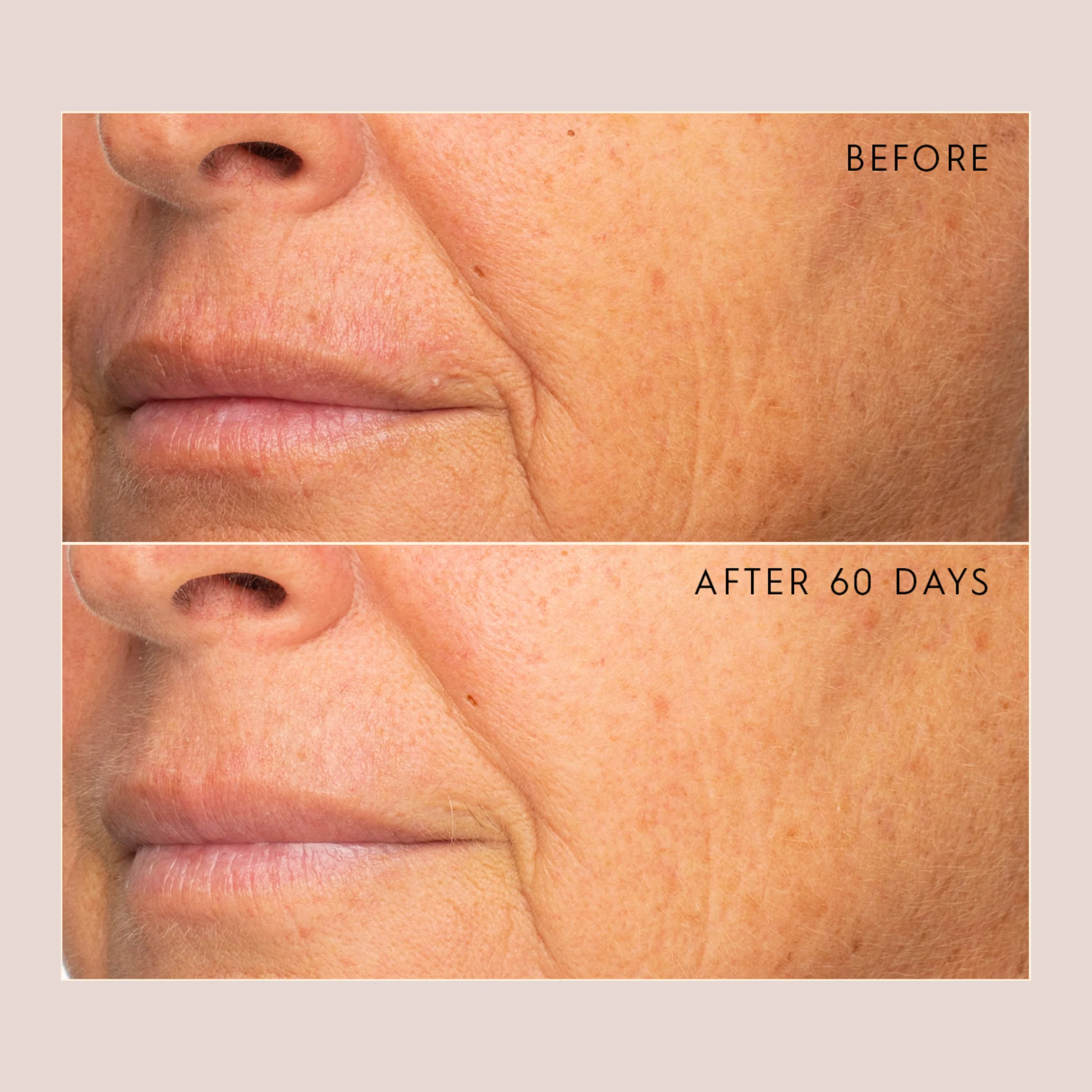 Daily At Home Facial - Image 4