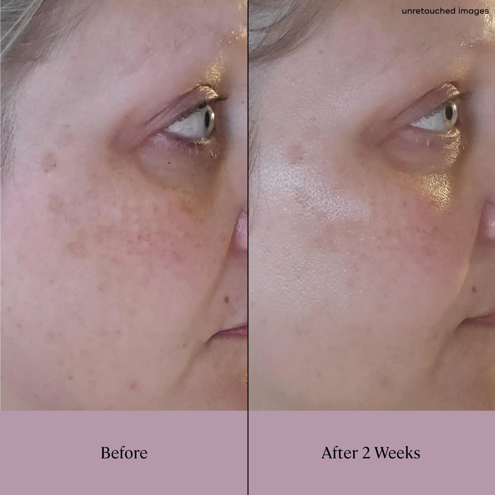 Day & Night Brightening Duo - Image 4